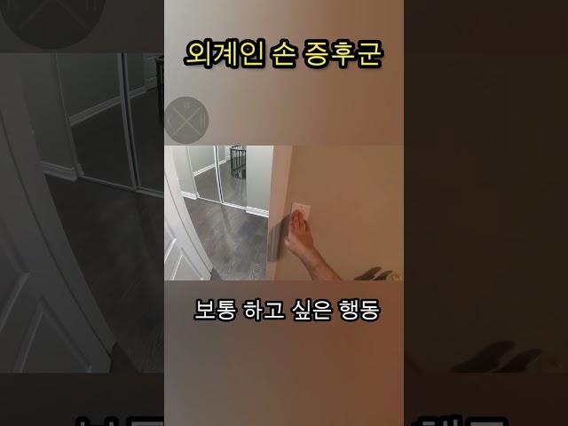외계인 손 증후군 #호기심