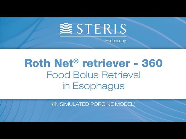ROTH NET™ Retriever - 360 | Food Bolus Retrieval in Esophagus
