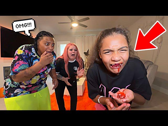 ALL MY TEETH  FALLING OUT SCARE PRANK ON PARENTS.. MUST WATCH!!