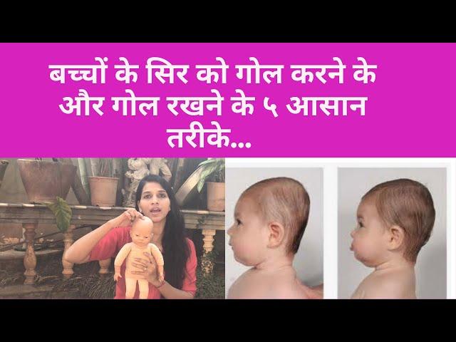 5 ways to correct baby head shape | Baby round head correction|Flat Head In baby Reasons & Cure