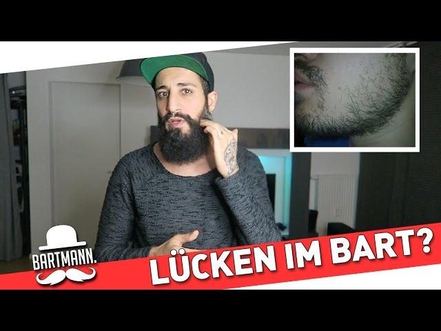 Lücken im Bart - Was tun?| BARTMANN