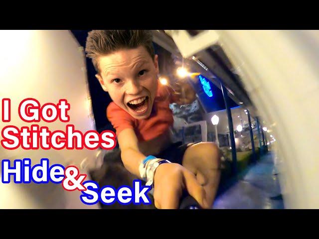 I got stitches playing Hide & Seek!