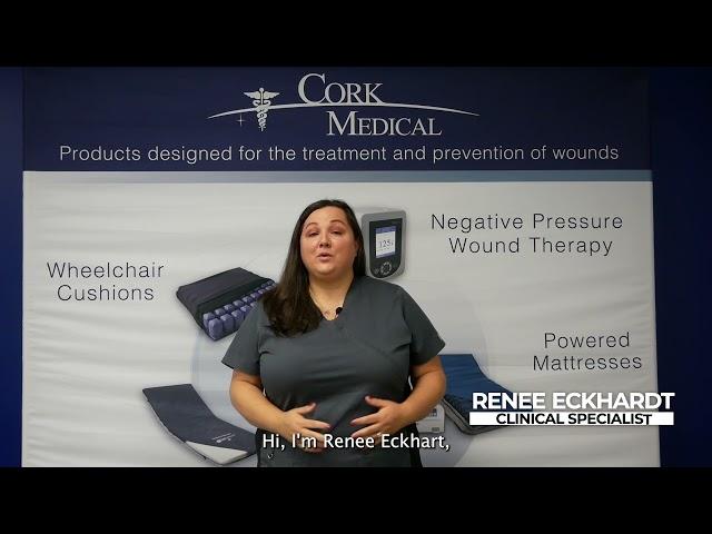 Coccyx-Sacral Application with a Bridge as part of Cork Medical's Negative Pressure Wound Therapy