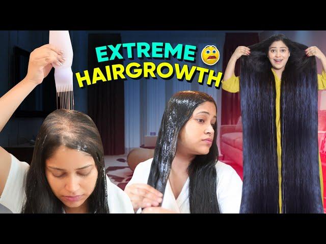 I Applied only Few Drops of this Diy & Got Triple Hairgrowth गंजेपन से तुरंत बचना है तो ये लगा लो