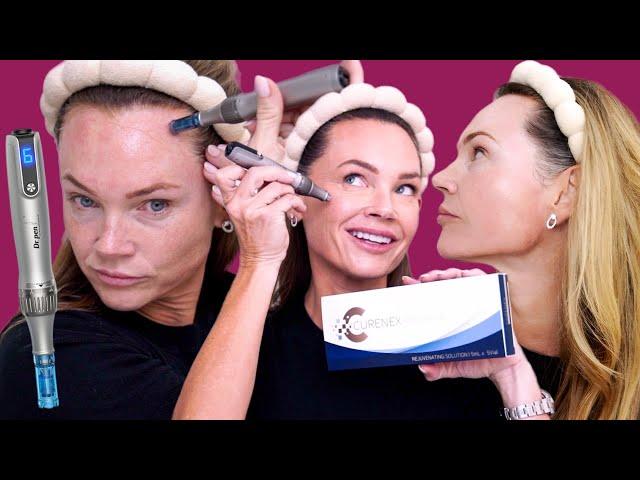 Microneedling at Home with Curenex & DR Pen M8S: The Secret to Glowing, Youthful Skin