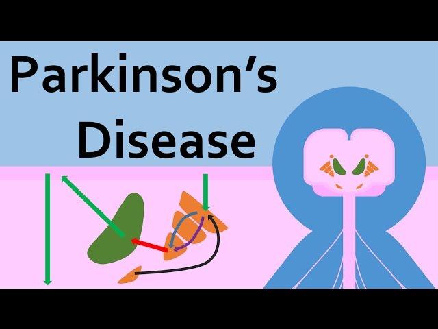 Parkinson's Disease and the Basal Ganglia