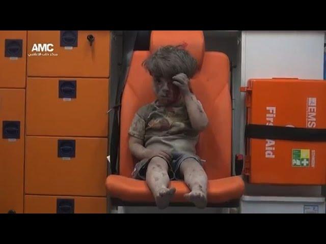 Wounded Syrian child sparks social media outrage