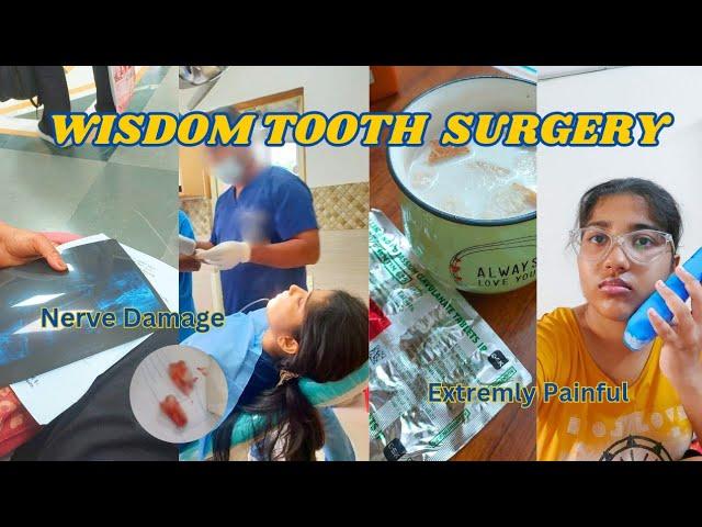 GETTING MY WISDOM TEETH REMOVED | Vlog & Recovery Process 