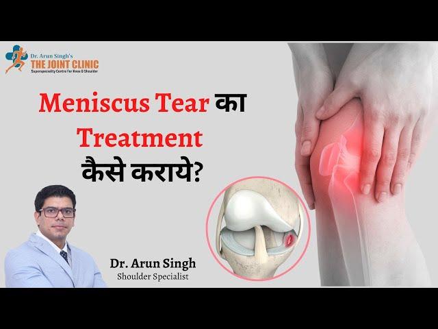 Meniscus tear का Treatment कैसे कराये | Treatment of meniscal tear | Dr Arun Singh