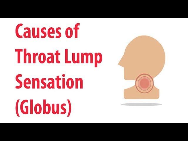 Causes of Throat Lump Sensation (Globus)