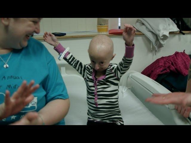 Progeria Update: Hope Grows for Girl With Rare Rapid-Aging Disease Progeria