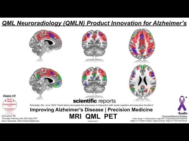 QML Neuroradiology QMLN Product Innovation for Alzheimer’s