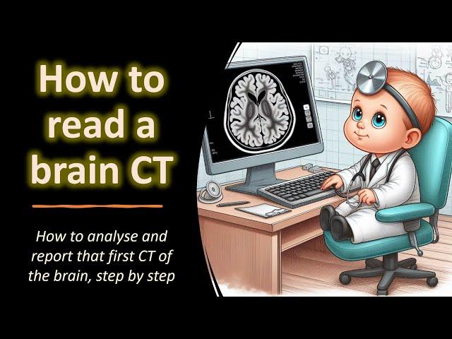 How to read a brain CT!