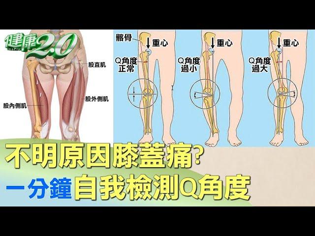 不明原因膝蓋痛? 一分鐘自我檢測Q角度 健康2.0