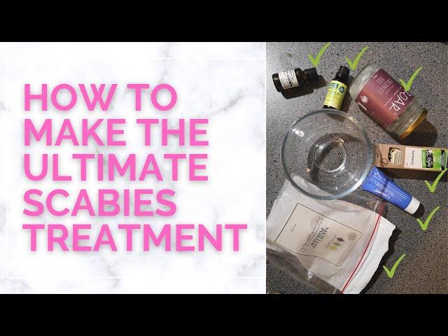 How To Make The Ultimate Scabies Treatment At Home (That Works!)