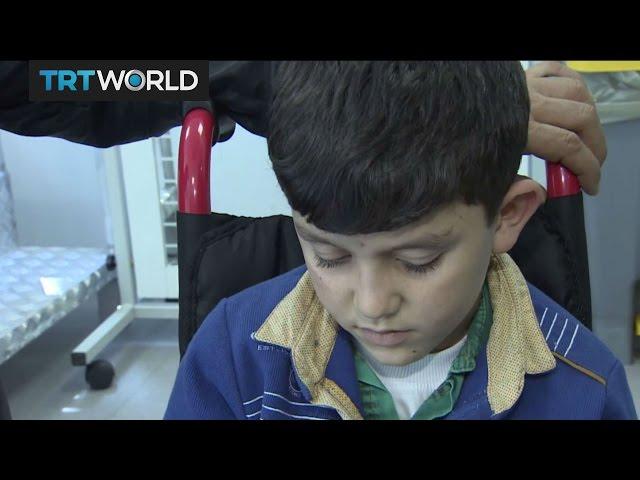 The War in Syria: Turkish prosthetic clinic helps Syrian kids