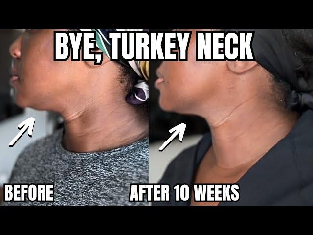 WOW---This Works for Turkey Neck, Rough Texture, Pores & MORE!