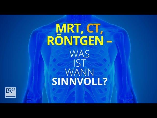 MRT, CT, Röntgen: Was ist wann sinnvoll und wie steht es um die Nebenwirkungen? | BR24