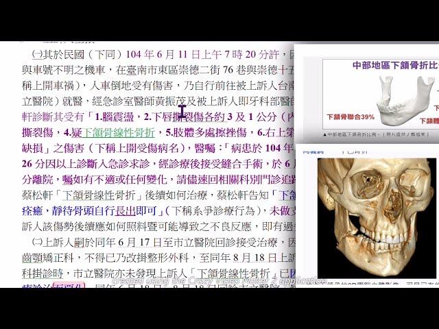 顳顎關節創傷或顎骨裂。司法敗類睜眼說瞎話，以明知不實之事證為判決基礎之枉法裁判。真無恥，應自行#切腹自殺以謝國人跟人民百姓，以免繼續禍害社會。高等法院 臺南分院 109 年度醫上字第 1 號民事判決