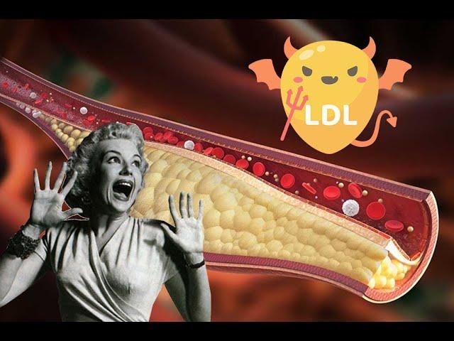 How I lost 80 points in LDL and 60 points in Total Cholesterol in 6 Months!