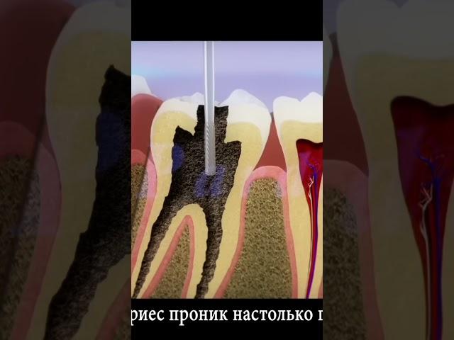 секреты стоматологии!
