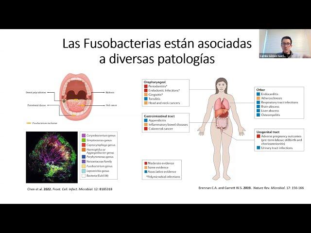 [Camilo Gómez-Garzón]  Cáncer Gástrico: ¿una historia de dos bacterias?