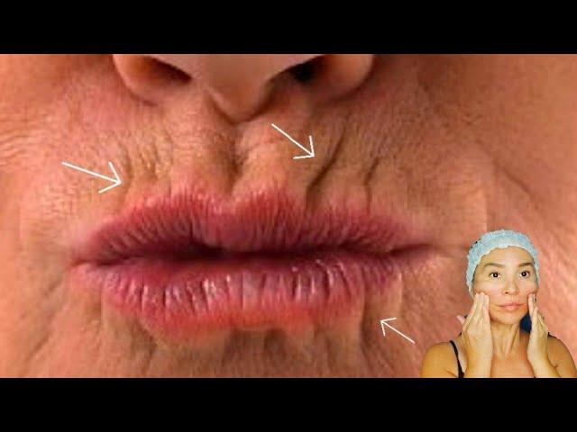 5 ways to GET RID of LIP WRINKLES | Lift up lip corners | Smokers lines