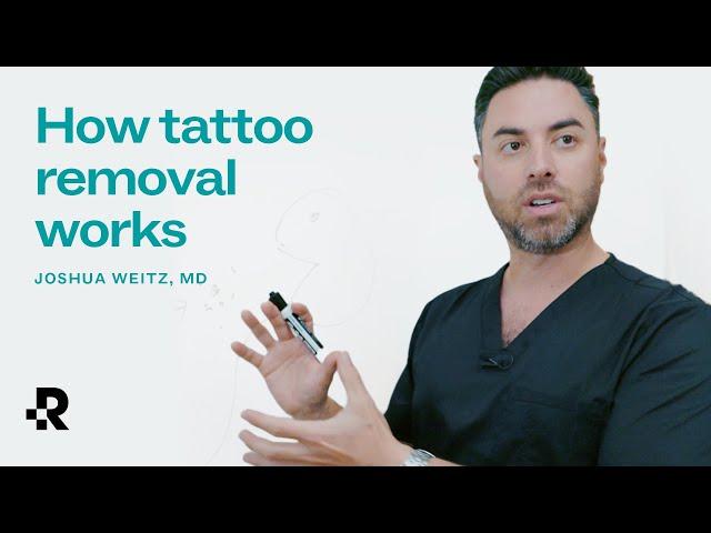 How Tattoo Removal Works