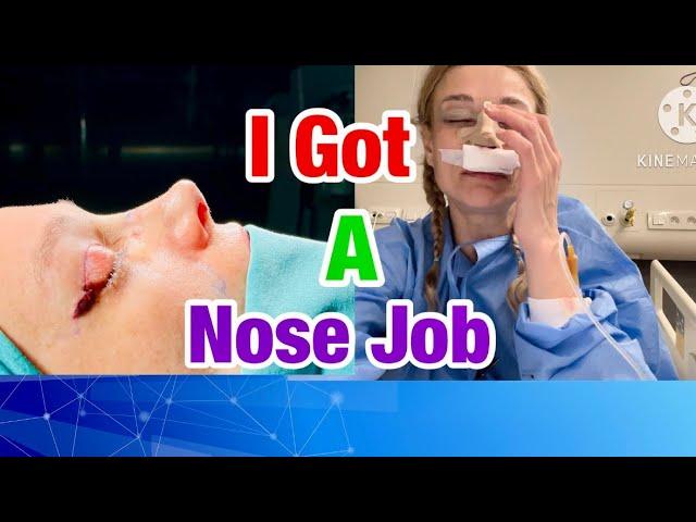 What They Don’t Tell You About Rhinoplasty | My Great Experiences