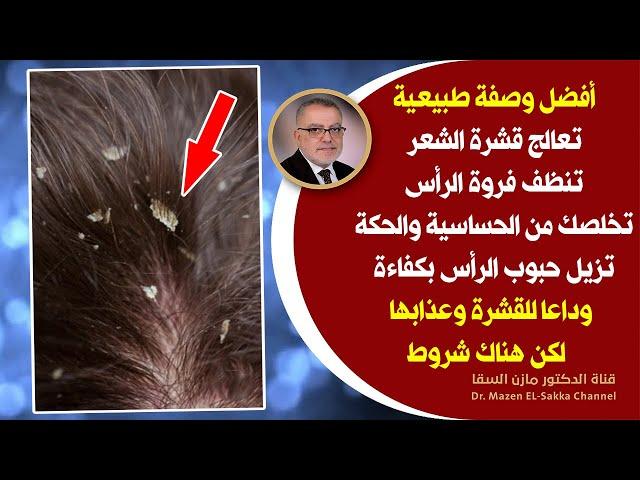 أعظم الهدايا الربانية يعمل ضد القشرة يعالج تساقط الشعربقوة يكافح القشره وحبوب وحكة فروة الرأس بكفاءة