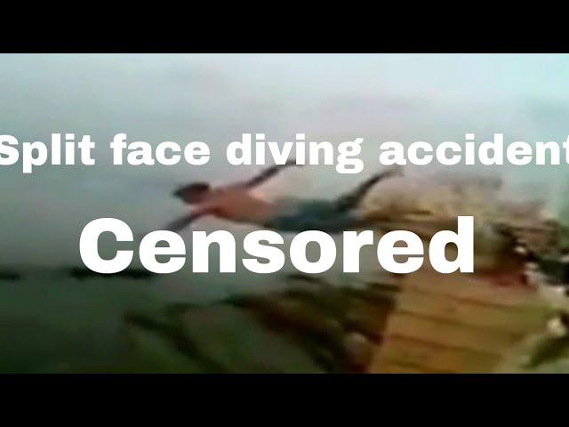 Split face diving accident (CENSORED)