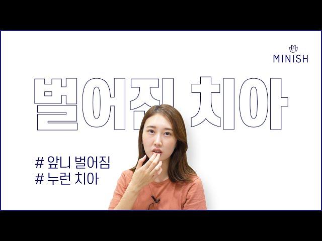 벌어진 앞니 교정 어떻게 치료할까요?｜미니쉬치과병원