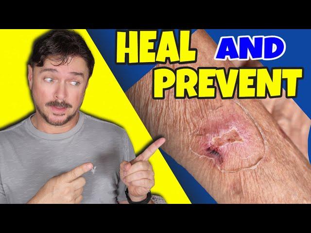 This Solves Skin Tears & Thin Skin Issues | Chris Gibson