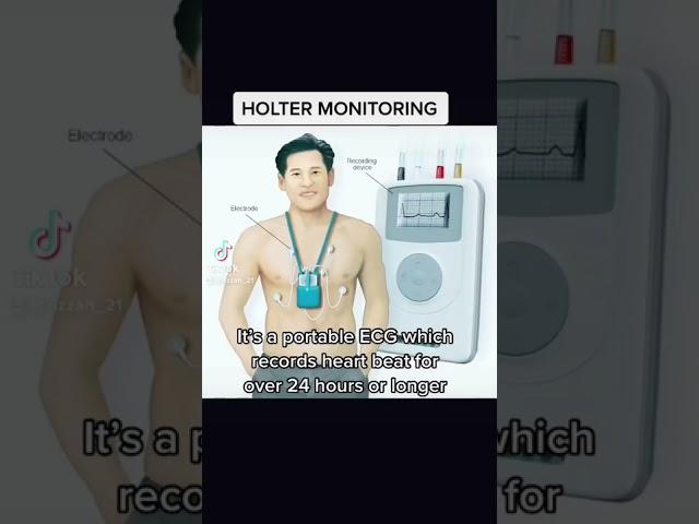 Holter monitoring