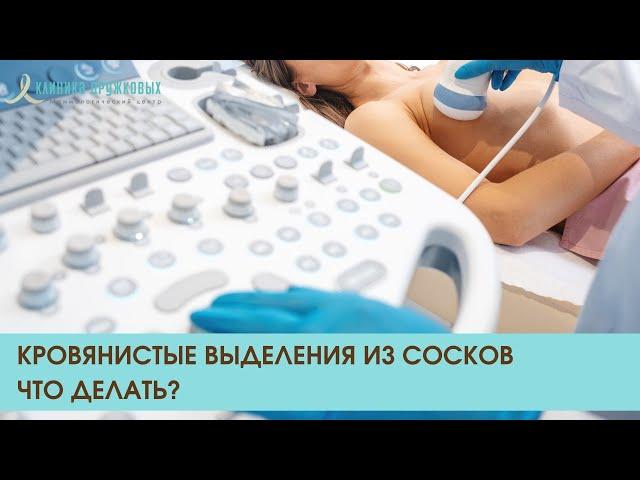 Кровянистые выделения из сосков. Лечение рака по ОМС в клинике Дружковых. Звоните 8 (800) 550-71-67.
