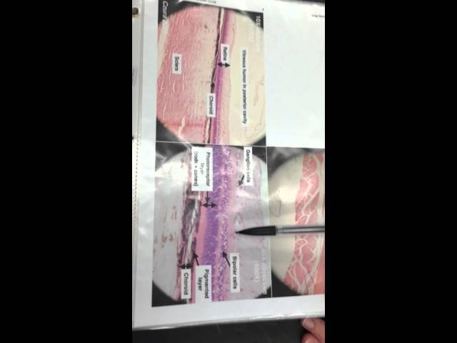 A&P1 retina slide