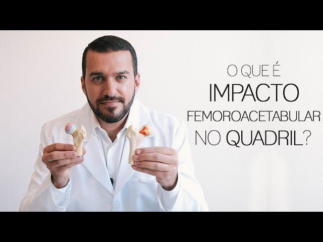 Impacto femoroacetabular, uma das principais causas da artrose de quadril - Dr. David Gusmão explica