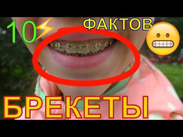 10 ФАКТОВ о МОИХ  БРЕКЕТАХ  РЕЗИНОЧКИ на БРЕКЕТЫ ? ЗАЧЕМ ? Для ЧЕГО? ЦВЕТ ? БОЛЬНО ?