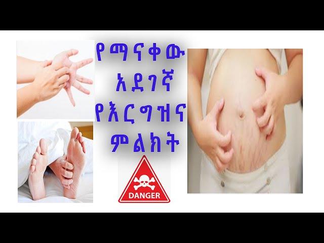 ብዞቻቹሁ  የማታውቁት አደገኛ የእርግዝና ምልክት/ pregnancy danger sign