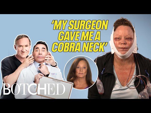 Lisa Is a Cougar With A Cobra Neck?! (Before & After) | Botched | E!