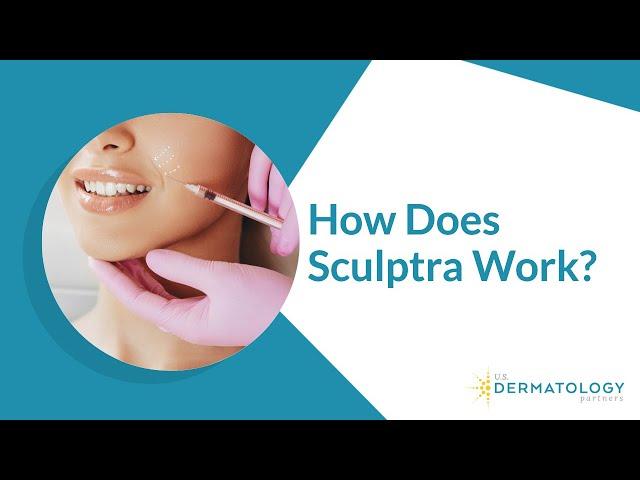 Sculptra Filler Treatment for Facial Volume