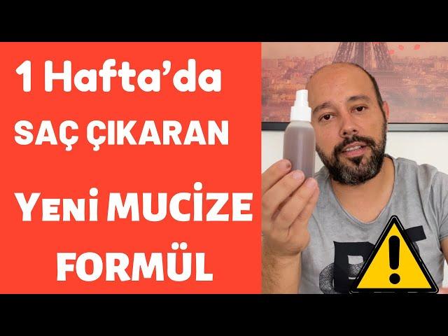 Saçlarım Yeniden Çıktı - Saç Çıkaran Mucize Doğal Kür