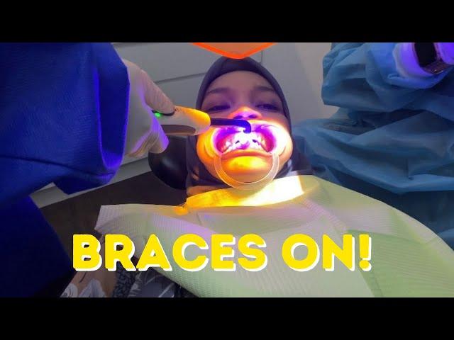 I GOT MY BRACES ON! | Malaysia