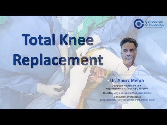 TKR by Dr Apurv Mehra Joint Replacement Surgeon (OT Recording)