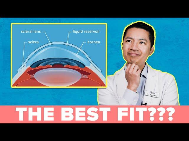 A MUST WATCH: How to Get the Best Scleral Lens Fit!!!!!