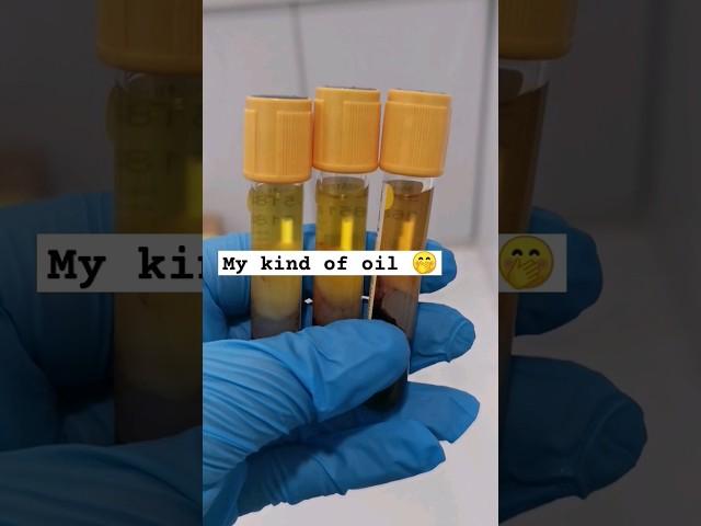 blood serum #medtechlife #cls #mls #laboratory #bloodgrouping #bloodtest #medtech