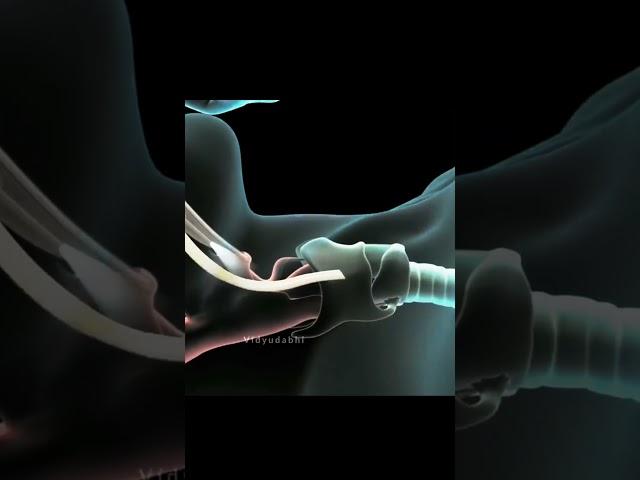 How Ventilator Works