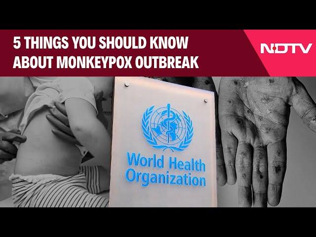 Monkeypox Virus | 5 Things You Should Know About MonkeyPox Outbreak