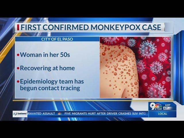 City of El Paso Public Health officials report first monkeypox case