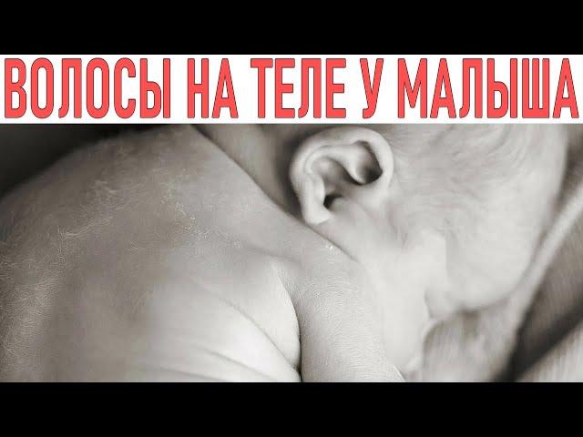 ЛАНУГО | Волосы на теле новорожденного | Особенности ухода за кожей новорожденного